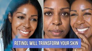 You Need To Try Olay Retinol24 Night Moisturizer Now (Before & After Shots) - SKIN TRANSFORMATION