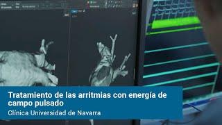 Tratamiento de las arritmias con energía de campo pulsado. Clínica Universidad de Navarra