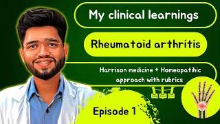 My Clinical Learnings | Rheumatoid arthritis | Medicine + Homeo approach & Imp rubrics / Dr. Chawda