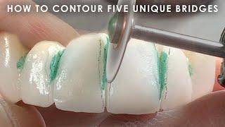 How to Contour Five Unique Bridges