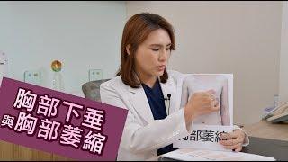 胸部下垂與胸部萎縮【晶華美醫診所】張子倩醫師｜隆乳女醫師 台北隆乳推薦 乳房重建 重建乳房