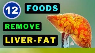 Eat These 12 Foods NOW to Detox and De-Fat Your Liver!