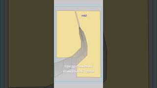 Эндодонтия: просто, понятно