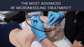 Tighten, Lift and Restructure the Face & Body with RF Microneedling