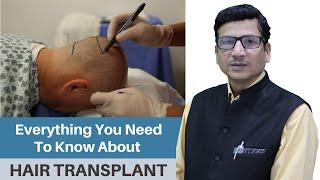 Everything You Need to Know About Hair Transplant ( Hair Restoration )  |  Dr. Anil Garg