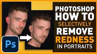 How to Selectively Reduce/Adjust Skin Redness in Photoshop