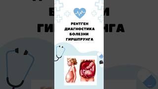 Ретген-диагностика Болезни Гиршпрунга