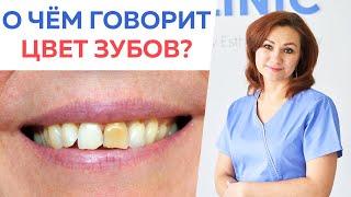 ТОП-6 причин изменения цвета зубов / О чем говорят ваши зубы?