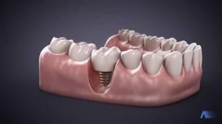 ▷ Vídeo Odontología 3D - GrupoAudiovisual.com