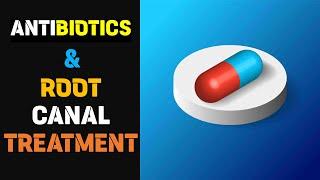 Antibiotics after Root Canal Treatment