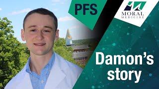 Physical Therapist still Suffering with PFS 6 Years after taking ONE Pill of Finasteride