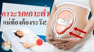 อาการคนท้อง : ภาวะรกต่ำ ที่คนท้องต้องระวัง | คนท้องรกต่ำ | คนท้อง Everything