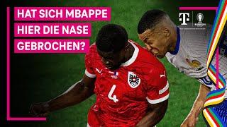 Nasenbruch bei Mbappe? Michael Ballack ordnet Situation ein | UEFA EURO 2024 | MAGENTA TV