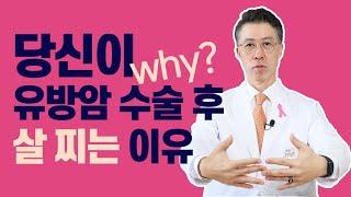 유방암 수술 후 왜 살이 찔까?