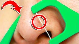 6 Clever Tricks To Unclog Pores INSTANTLY!