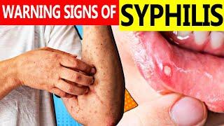 Syphilis in Adults | Early Warning Signs of Syphilis | 6 Signs & Symptoms of Syphilis in 2 minutes