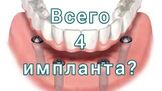 Имплантация зубов ВСЕ НА 4.  ПРОТЕЗ на 4 имплантах. НЕСЪЕМНЫЙ протез на 4 имплантах.