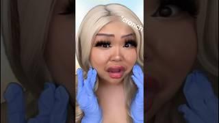 ASMR Botox Gone WRONG ‼️‼️ #asmr #tingly