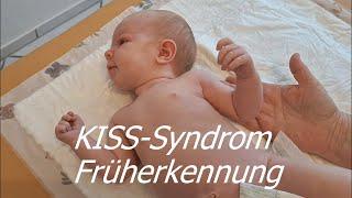 KISS Syndrom: Früherkennung bei Babys von Geburt an.