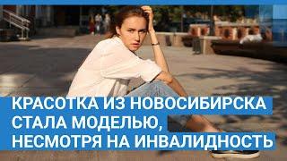 Красотка из Новосибирска смогла стать моделью, несмотря на инвалидность | NGS.RU