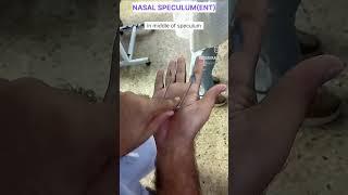 How to hold nasal speculum (ENT) .  #Ent #mbbs #medicalstudent #neet #ward