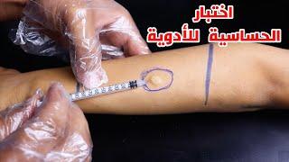 تعلم الطريقة الصحيحة لعمل اختبار حساسية للأدوية_correct way to perform a drug sensitivity test