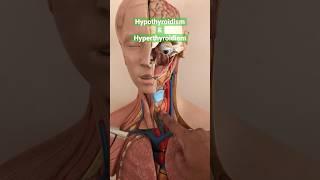 Hypothyroidism & Hyperthyroidism - Natural Treatment #thyroid