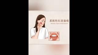 Know more Lupus erythematosus 了解更多红斑狼疮(國語版本)