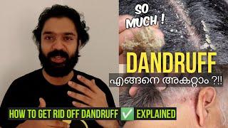 എങ്ങനെ താരൻ Dandruff അകറ്റാം?!! Things to Know, Facts, Natural Remedies, How to Maintain explained