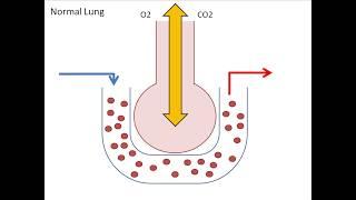 Why COPD patients retain CO2 when we give them supplemental O2