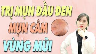 TRỊ MỤN ĐẦU ĐEN Ở MŨI tưởng khó mà dễ. 5 cách trị mụn đầu đen, mụn cám ở mũi hiệu quả|Bs Nguyễn Ngọc