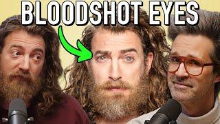 Why Rhett's Eyes Are Always So Red