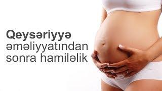 Qeysəriyyə əməliyyatından sonra hamiləlik - Mama-ginekoloqu - Aidə Hüseynova