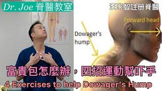 富貴包怎麼辦，四招運動幫吓手  [Eng Subtitles] 4 exercises to help Dowager’s hump