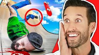 ER Doctor REACTS to Most PAINFUL Skateboarding Fails Ever