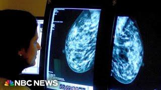 American Cancer Society report finds rise in breast cancer cases in younger women