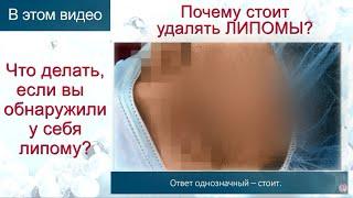 Как выглядит ЛИПОМА? Чем опасны липомы? Что будет, если не удалить вовремя? Врач-хирург отвечает.