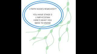 Have you had lymph nodes removed? If so, here's what you NEED to know!