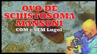 Ovo de Schistosoma Mansoni em Lâmina | Com lugol e Sem Lugol | Parasitologia | Bioquímica de Forma