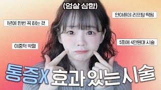 티 안나게 예뻐짐  여태받은 시술들 다 알랴드림 안 아프지만 효과좋은 피부과 시술들