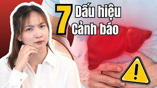 7 DẤU HIỆU CẢNH BÁO SỚM GAN ĐANG CÓ VẤN ĐỀ | Bác Sĩ Hoa