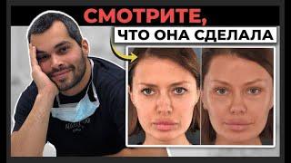 Пластика Виктории Бони за 20 миллионов:стоила ли она того? | Разбор операции