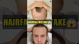  Biggest Hair fall Mistakes | #shorts #mensfasion #hairfall