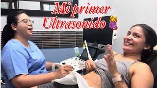 MI PRIMER ULTRASONIDO DE EMBARAZOTengo 6semanas 4días ¡MORIMOS DE LA EMOCIÓN!️| AleU de AloChapin