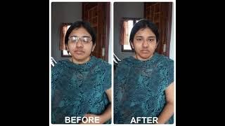 Amar Eye Exercise Yoga Auroville