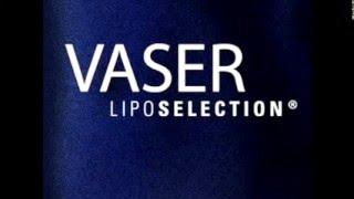 Vaser Liposuction  in Hyderabad 威塑抽脂脂肪雕刻