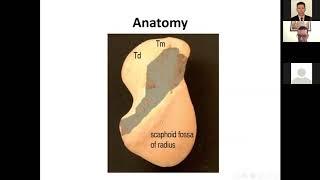 Prof Ahmed Naeem Atyyia non united fr scaphoid