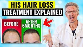 MUST SEE! HAIR LOSS TURNAROUND IN JUST 6 MONTHS: HOW? MENS HAIR LOSS TREATMENT EXPLAINED