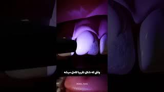  عاقبت دندون شکسته| فکت های فارسی و دانستنی ها #دانستنی #فکت #علم  #short #shorts