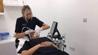 Hydrafacial Treatment in Kent - Dr Shirin having a Hydrafacial Treatment